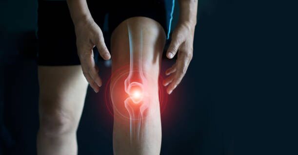 Kniegelenks -Osteoarthritis