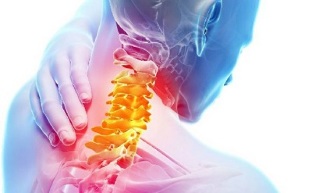 Symptome einer Osteochondrose der Halswirbelsäule